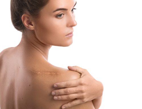 Arrskader og deformitet